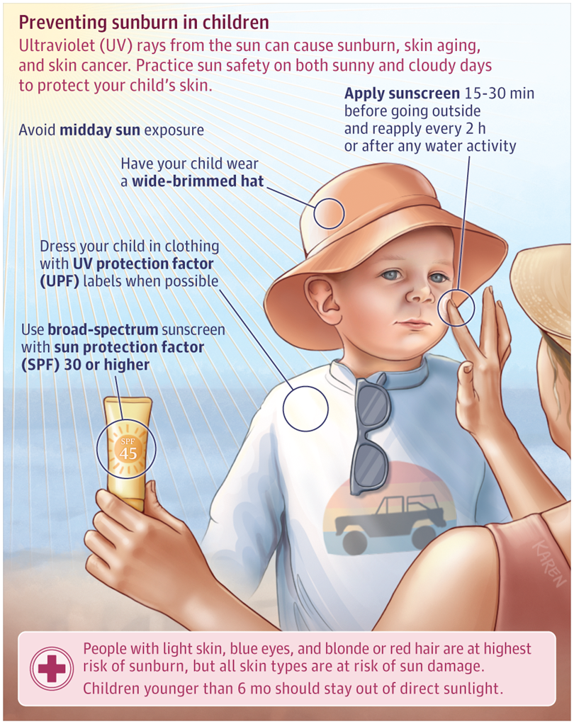 Protect Your Neck from Harmful Sun « Daily Bulletin